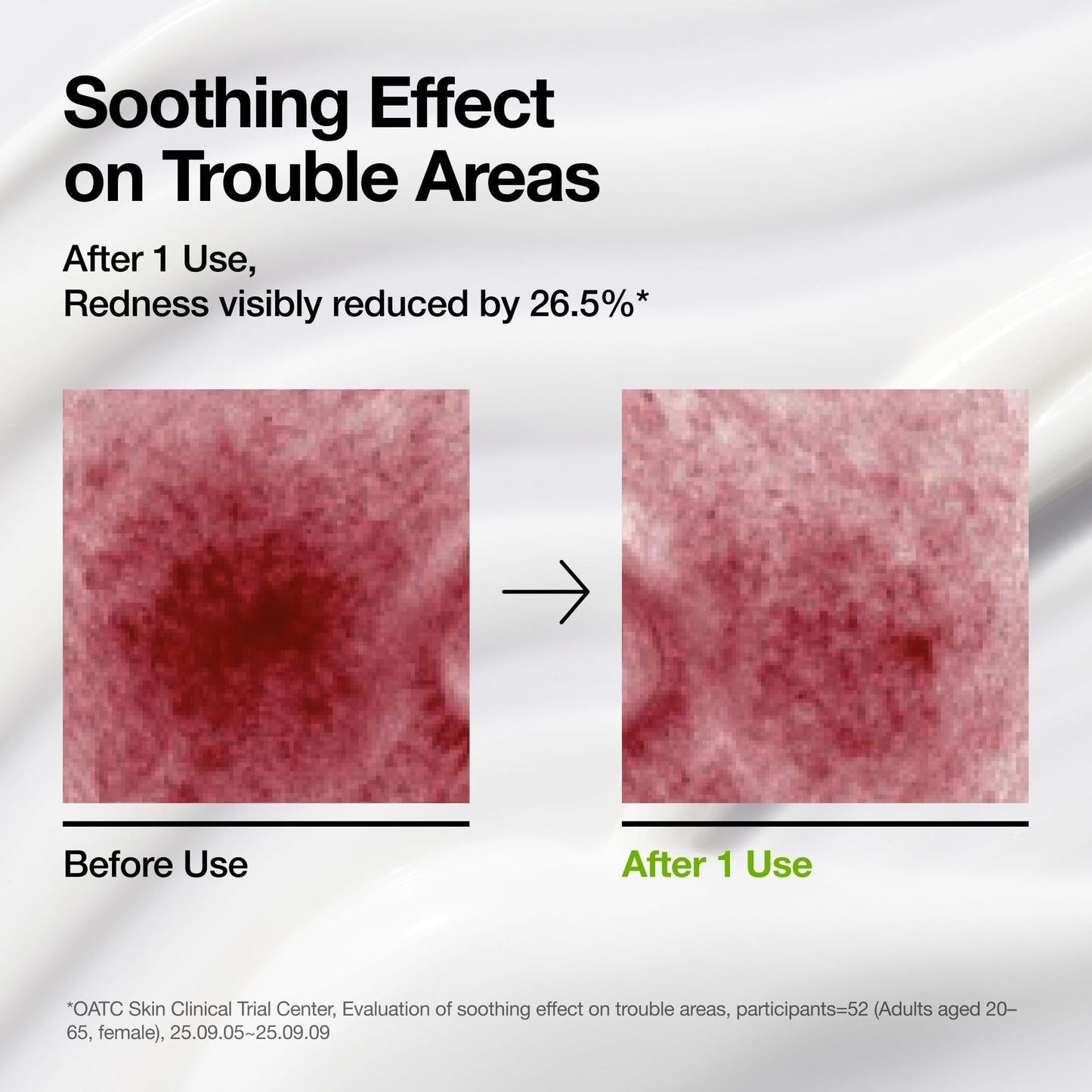 Azelaic Acid CICA Skin Soothing Moisturizer