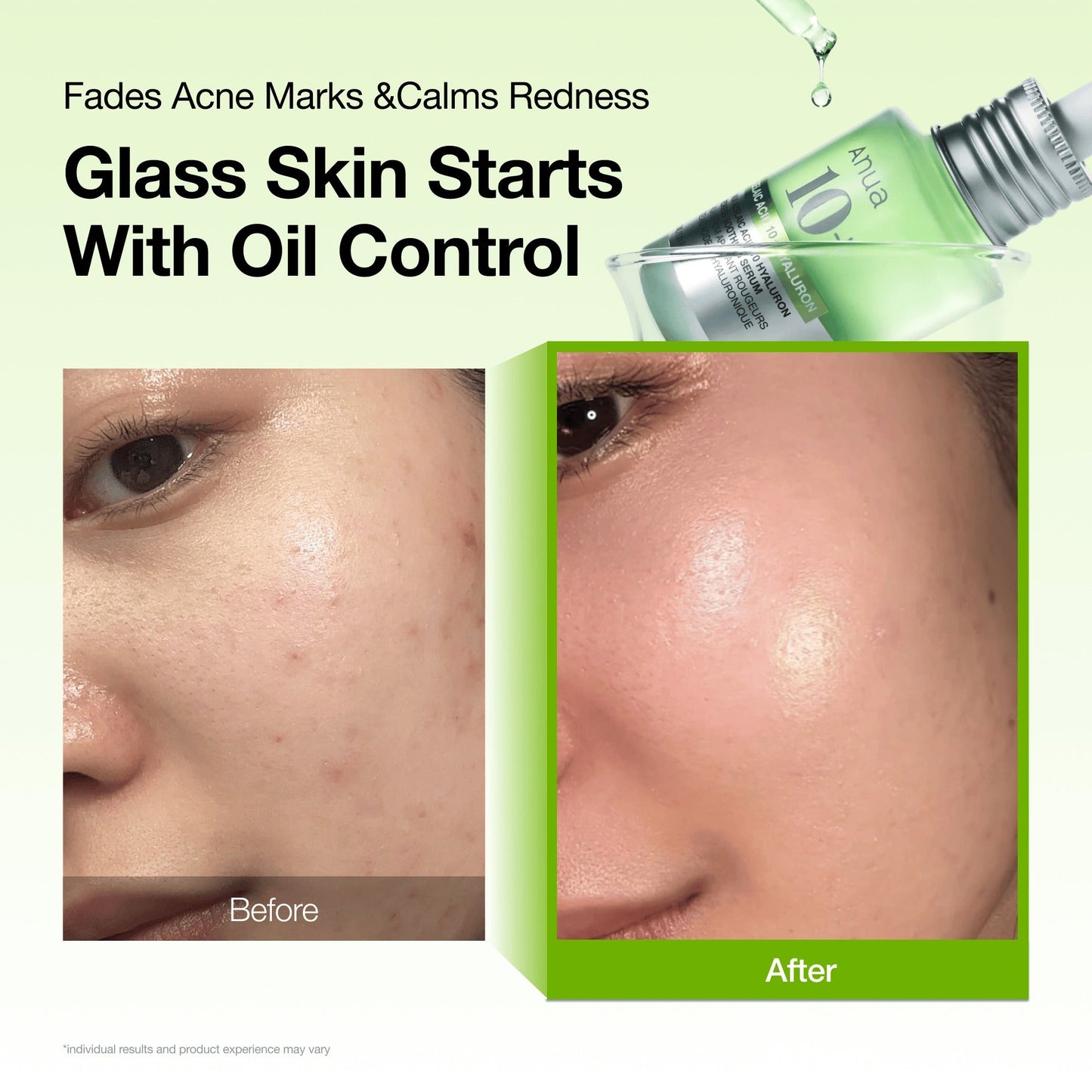 [Secret Deal] Azelaic Acid Redness Soothing Serum