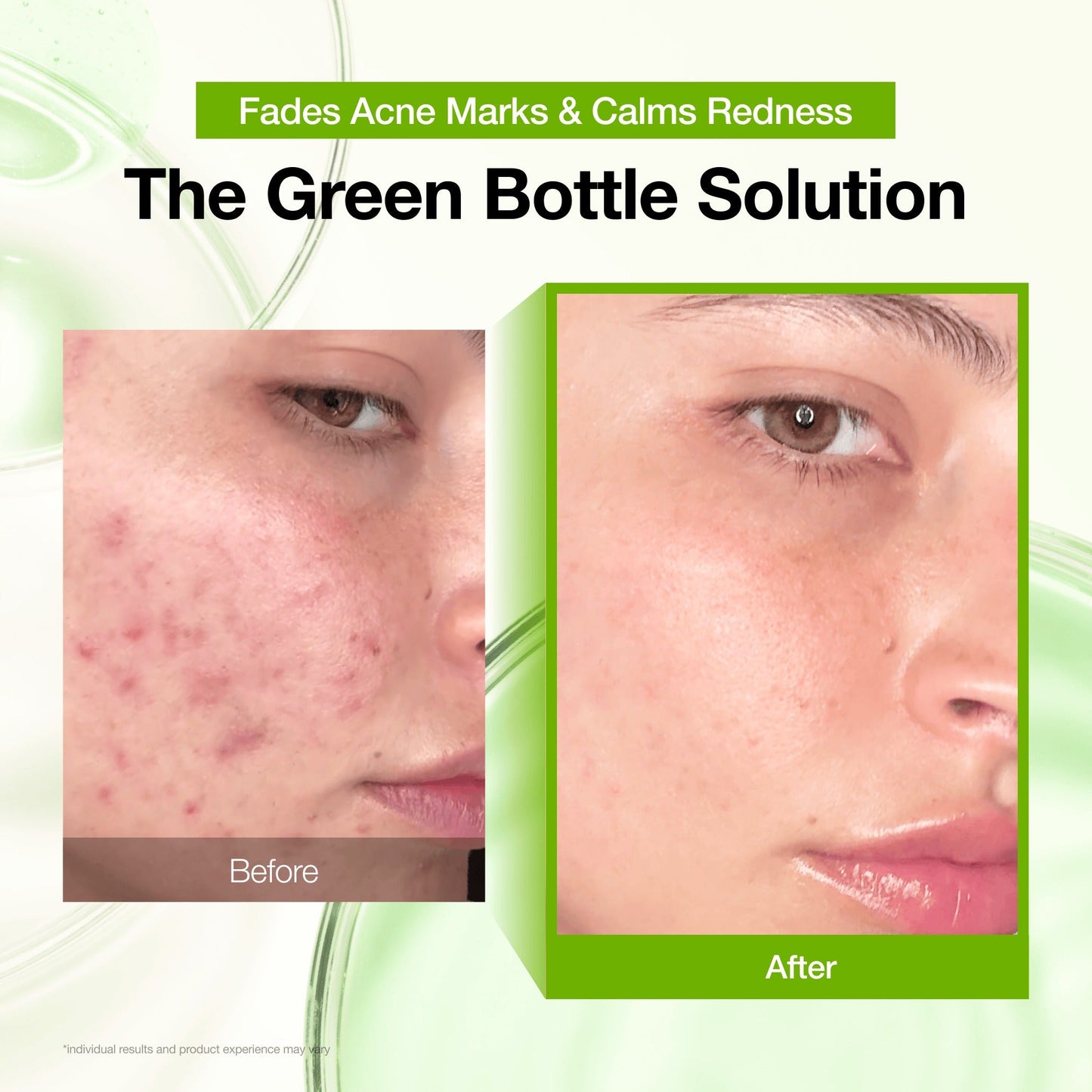 [Secret Deal] Azelaic Acid Redness Soothing Serum