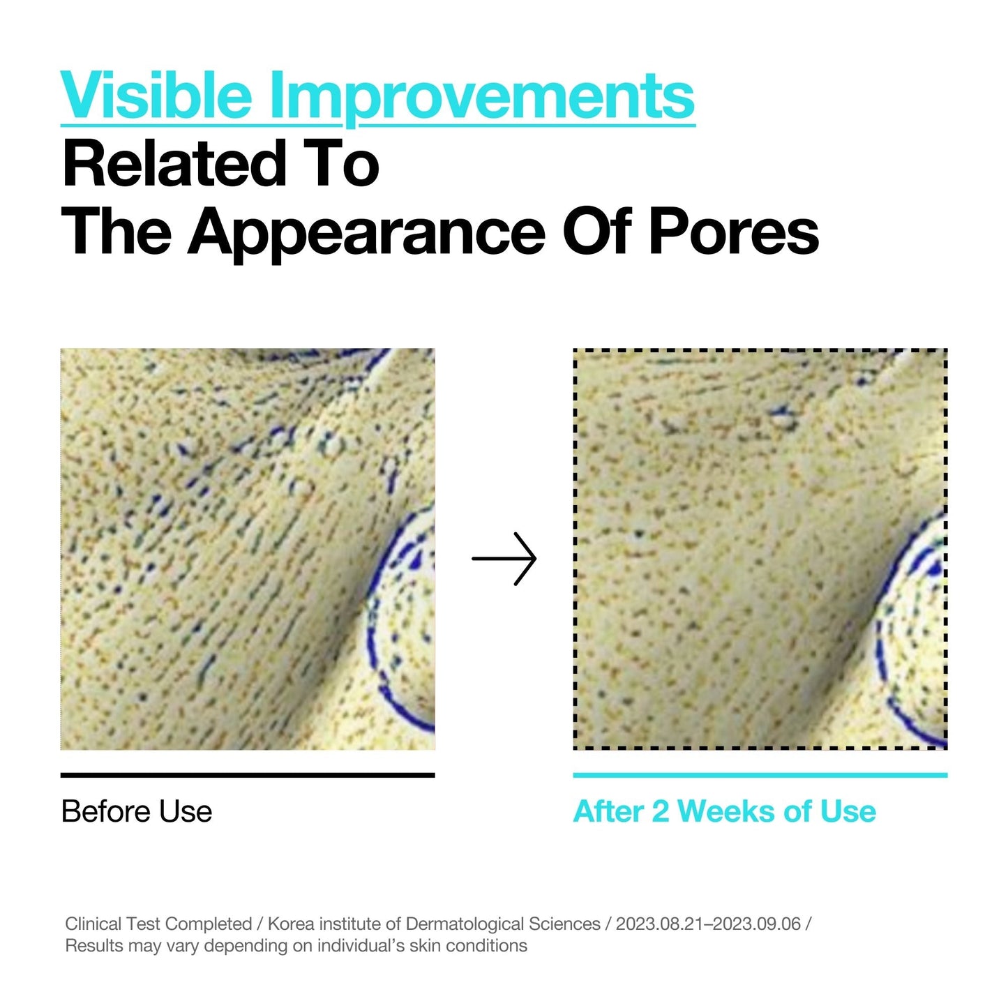 Even tone & Pore Refining Duo