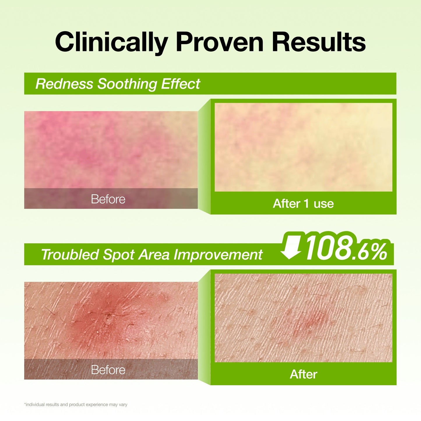[Secret Deal] Azelaic Acid Redness Soothing Serum